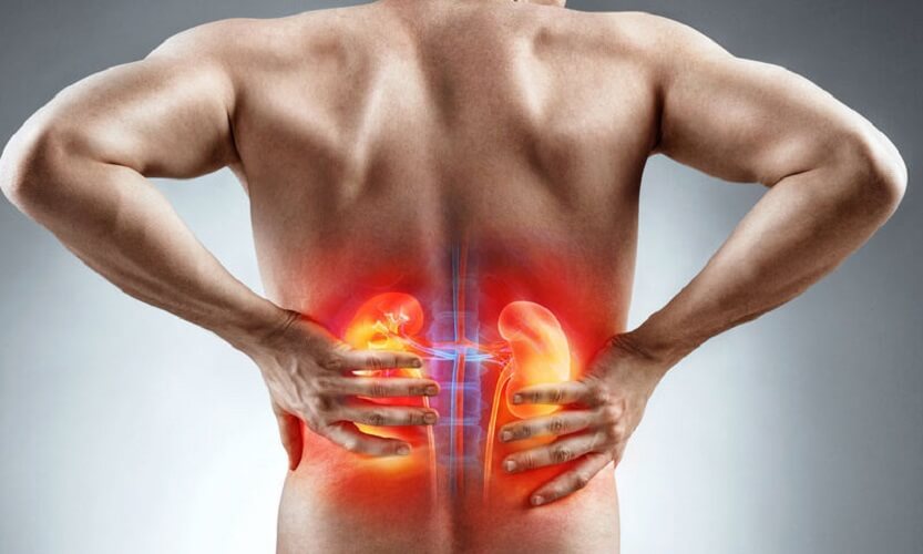 Ayurvedic Treatment for Chronic Kidney Disease