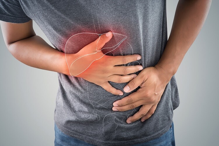 Ayurvedic Treatment for Fatty Liver