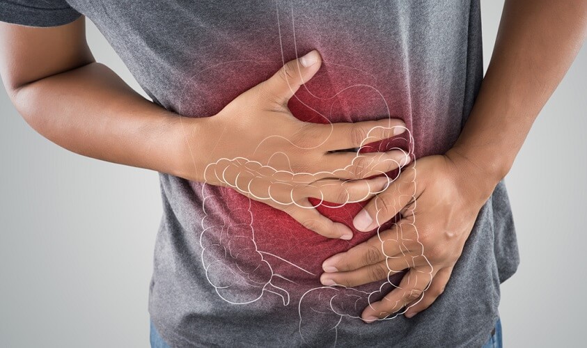 Ulcerative Colitis Ayurvedic Treatment