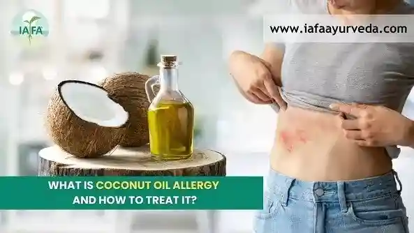 What is Coconut Oil Allergy and How to Treat It?