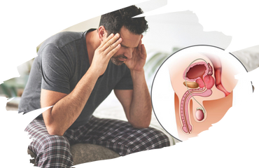 Erectile Dysfunction Ayurvedic Treatment